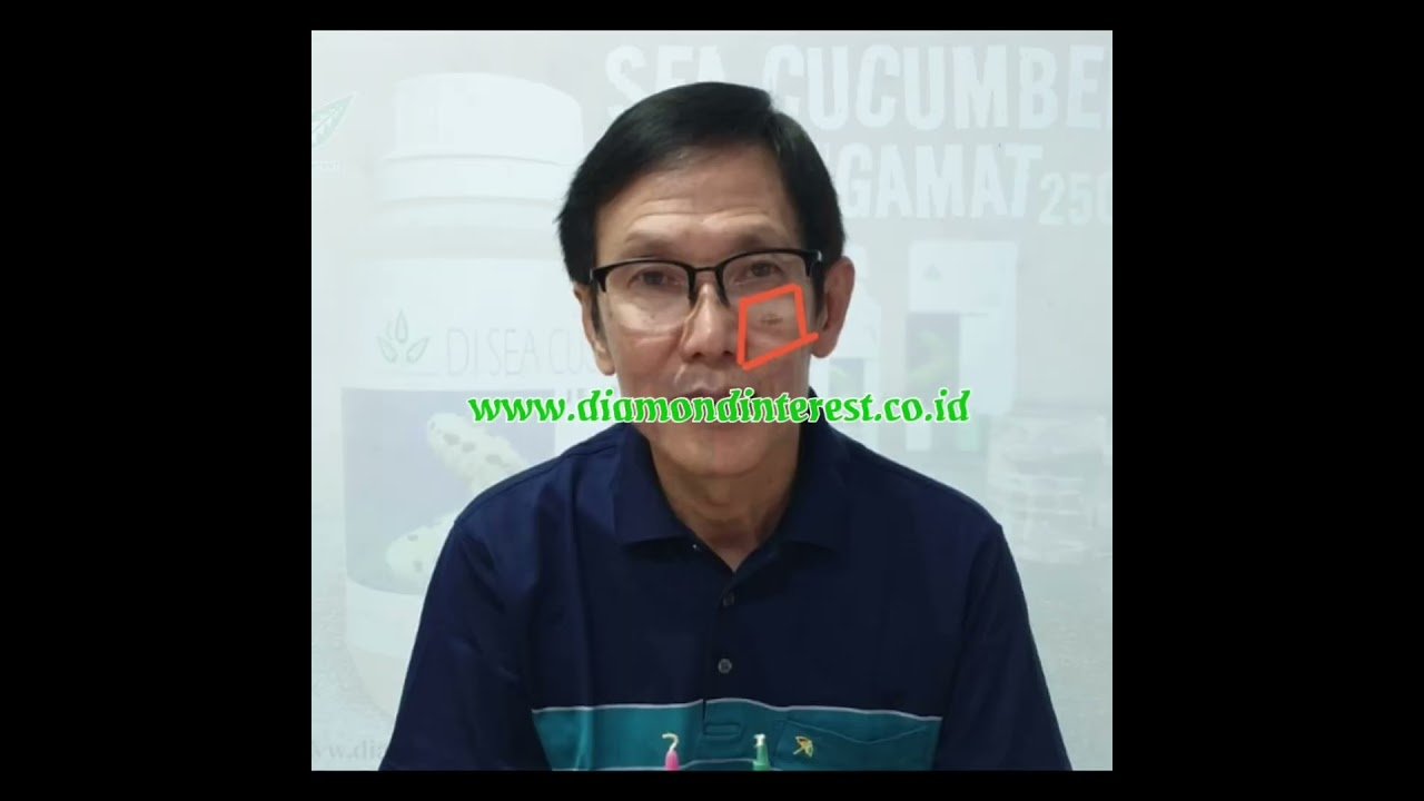 Flek Hitam di Wajah Pada Laki-Laki