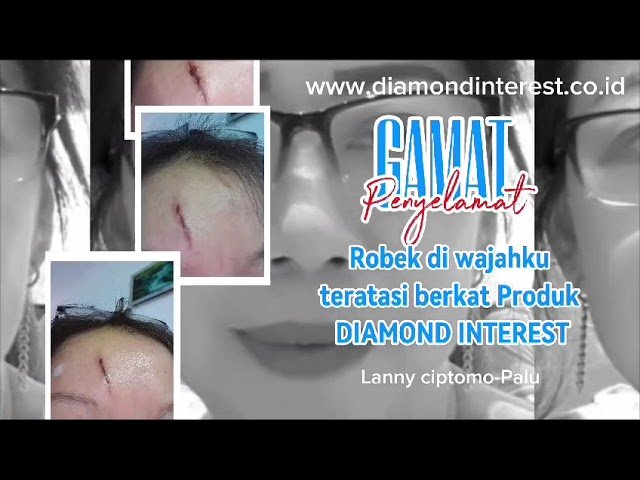 TESTIMONIAL SUPLEMEN DIAMONDINTEREST