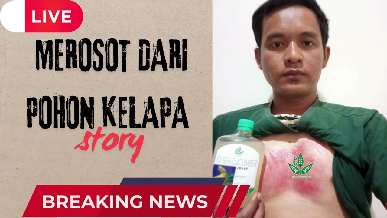 Video Testimoni Ridwan BDG GCR