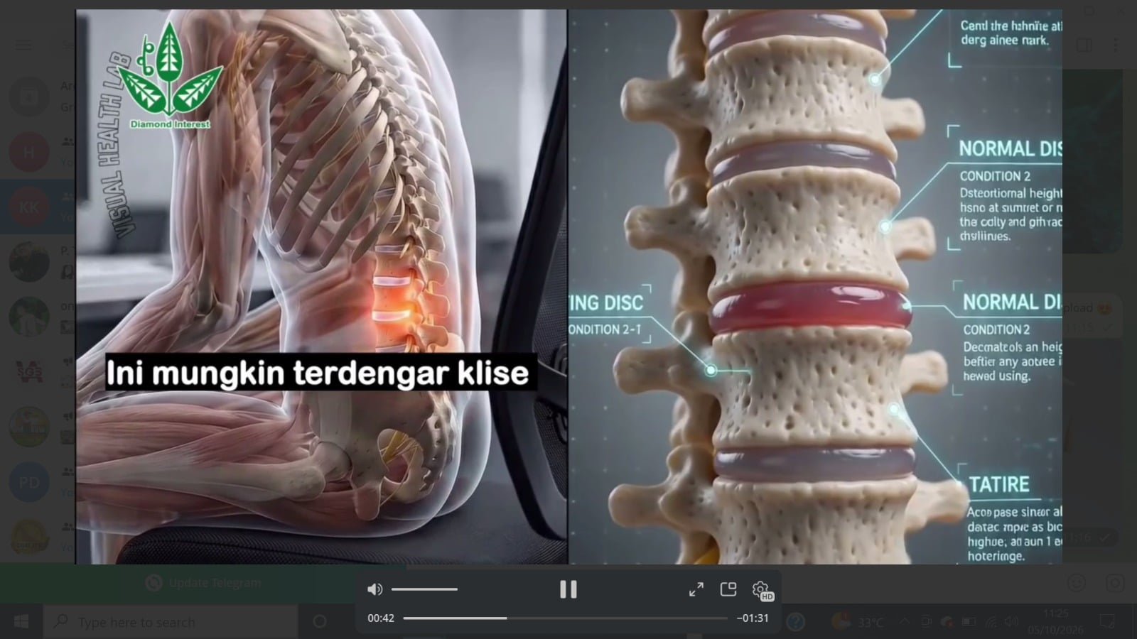 Read more about the article LOW BACK PAIN – dr. ZEN DJAJA